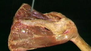 4.2 De spieren van de schouder_Picture