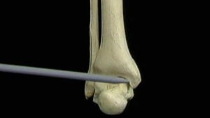 4.4 Het skelet en de gewrichten en ligamenten van de bovenarm en de onderarm_Picture