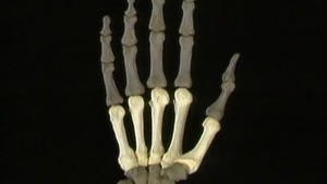 4.7 Het skelet en de gewrichten en ligamenten van de hand_Picture