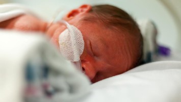 Frühgeborenes in Klinik