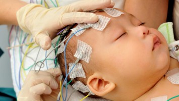 EEG bei einem Kleinkind