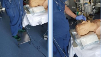 Fiberoptische Wachintubation