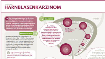 Infografik Harnblasenkarzinom