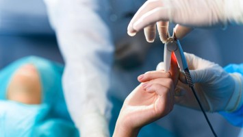 Fingerpulsoximeter bei Operation