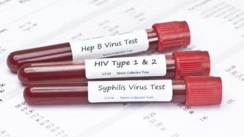 Drei Blutteströhrchen für sexuell übertragbare Infektionen