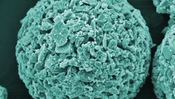 Heavy Charge Against Water Germs