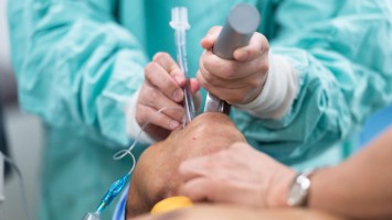 Intubation