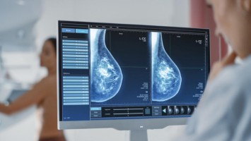Ärztin betrachtet Mammografie-Befund