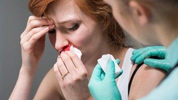 Behandlung von Nasenbluten