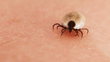 Zecke auf menschlicher Haut