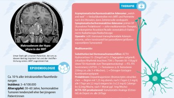 DGN Zoom Infografik HYPOPHYSENADENOM