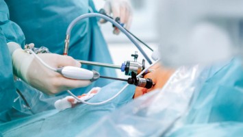 Laparoskopischer Eingriff
