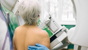 Ältere Frau bei Mammografie