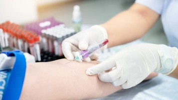 Frau nimmt Blut am Arm ab