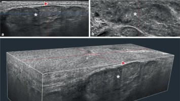 Konfokale optische Kohärenztomographie mit Line-Field-Technologie