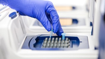 Person setzt DNS-Probe in Maschine ein