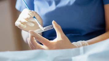 Zytologischer Abstrich bei gynäkologischer Untersuchung