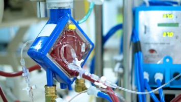 Oxygenator eines ECMO-Geräts