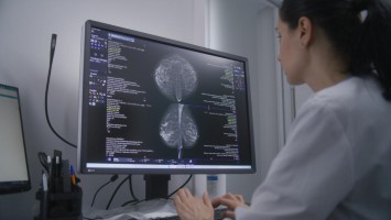 Junge Ärztin betrachtet Mammografie-Bild