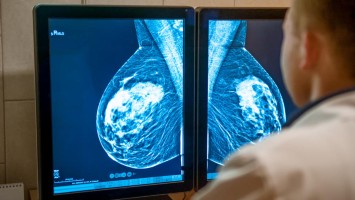 Arzt untersucht Mammogramm