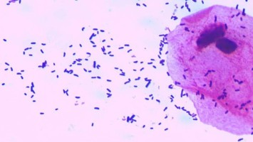 Gram-Färbung des Flours einer vaginal gesunden Frau