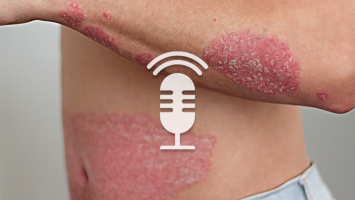 Springer Medizin Podcast - Psoriasis