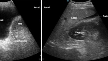Point-of-care-Ultraschall bei Trauma