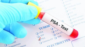 PSA-Test