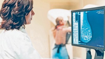 Mammographie 