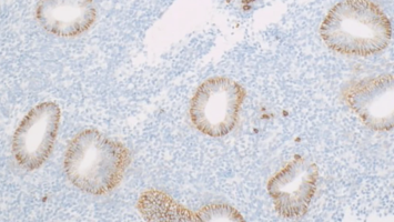 Endometriumbiopsat vom 19. Zyklustag im Phantomzyklus