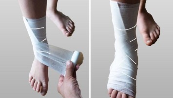 Anlegen eines Fixierverbands am Knöchel