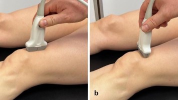 Gelenkultraschall am Knie