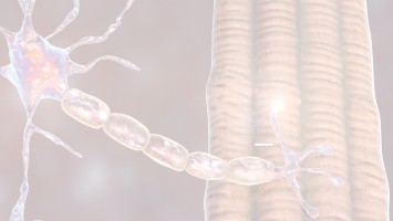 Teaserbild: Komplementinhibition bei generalisierter Myasthenia gravis