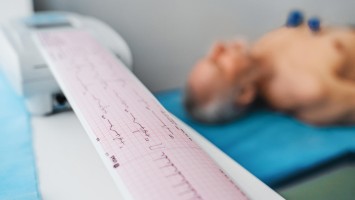 EKG-Kontrolle in einer Praxis