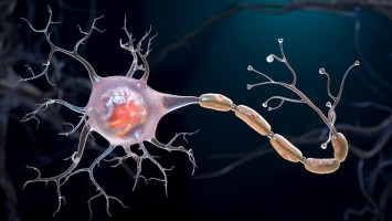 Teaserbild: Aktive schubförmige Multiple Sklerose