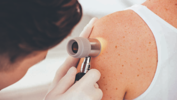 Dermatologische Untersuchung