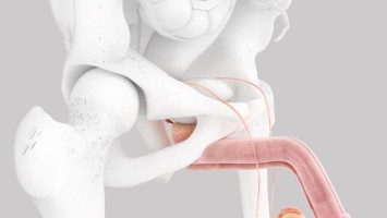 Penis, Hoden, Samenleiter (Achtung: gekontert!)