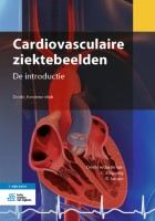 Cardiovasculaire ziektebeelden