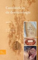 Casuïstiek in de dermatologie