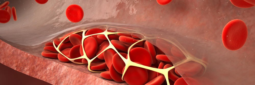 Herzerkrankungen Und Komorbiditat Herzerkrankungen Und Komorbiditat Springermedizin De