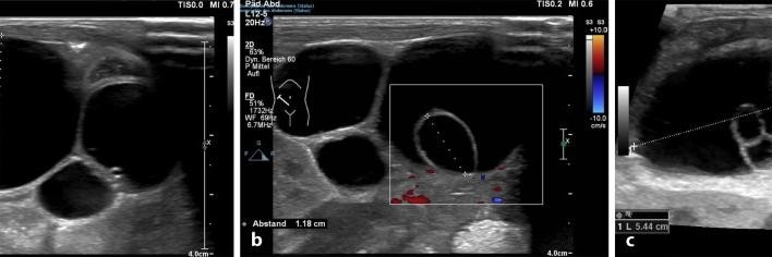 Padiatrische Radiologie Padiatrische Radiologie Springermedizin De