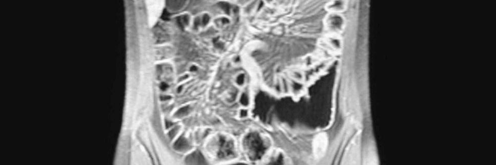Radiologische Techniken Und Methoden Radiologische Techniken Und Methoden Springermedizin De