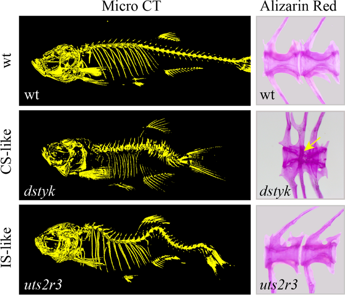 Zebrafish: an important model for understanding scoliosis