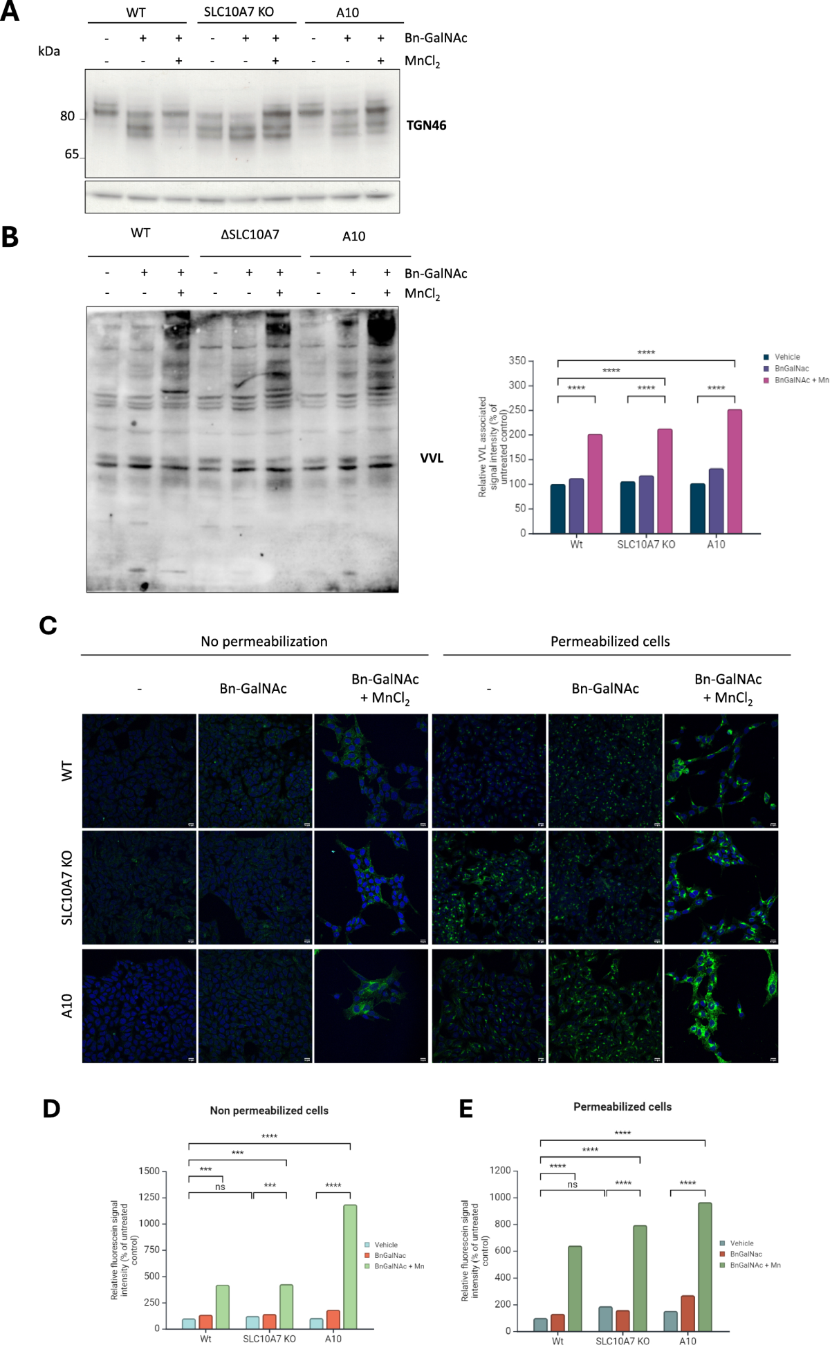 SLC10A7 regulates O-GalNAc glycosylation and Ca2+ homeostasis in the  secretory pathway: insights into SLC10A7-CDG | Cellular and Molecular Life  Sciences | Springer Nature Link
