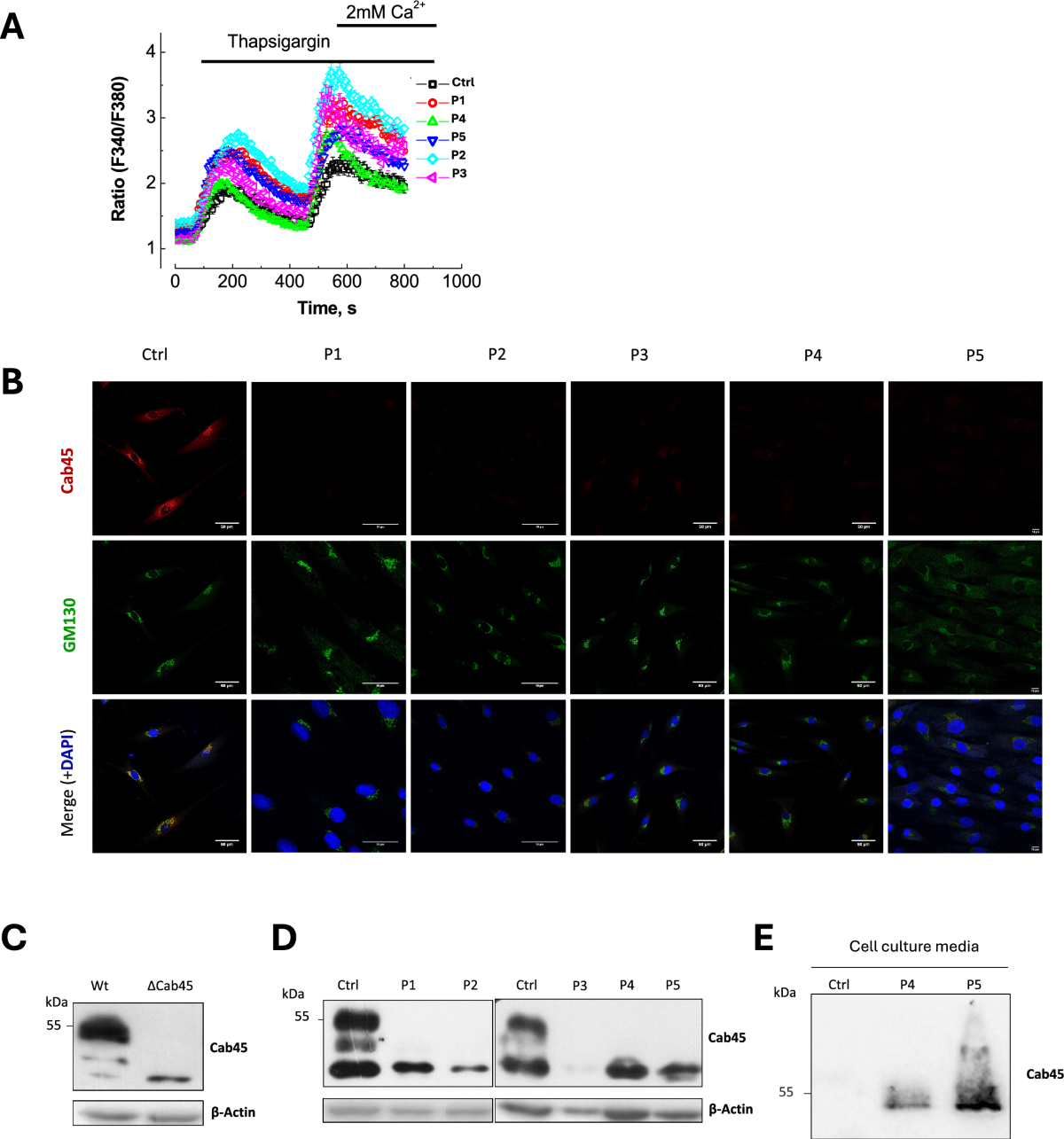 SLC10A7 regulates O-GalNAc glycosylation and Ca2+ homeostasis in the  secretory pathway: insights into SLC10A7-CDG | Cellular and Molecular Life  Sciences | Springer Nature Link