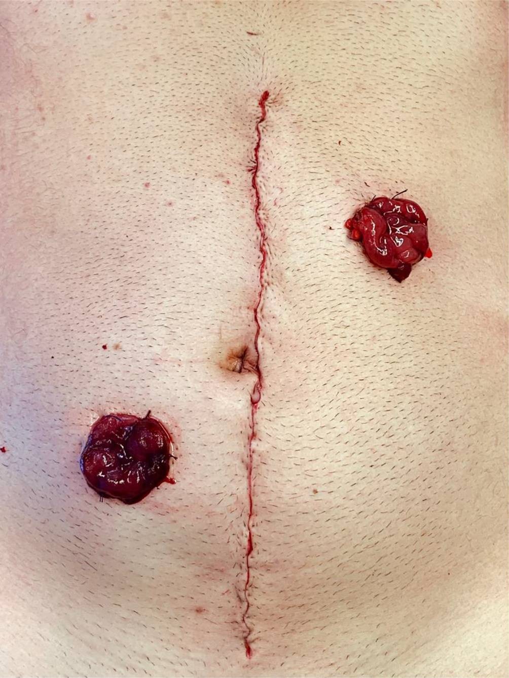 künstliche zuckerersatzstoffe Mönchsfrucht Zuckerersatz 1 kg