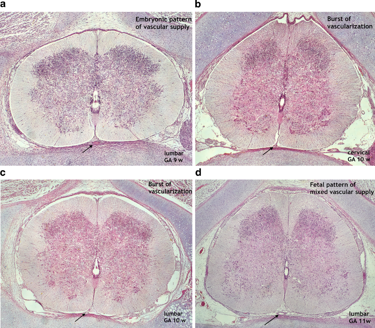 Spinal Cord Cerebrospinal Fluid In Powerpoint And Google Slides Cpb, image size:1200x1051