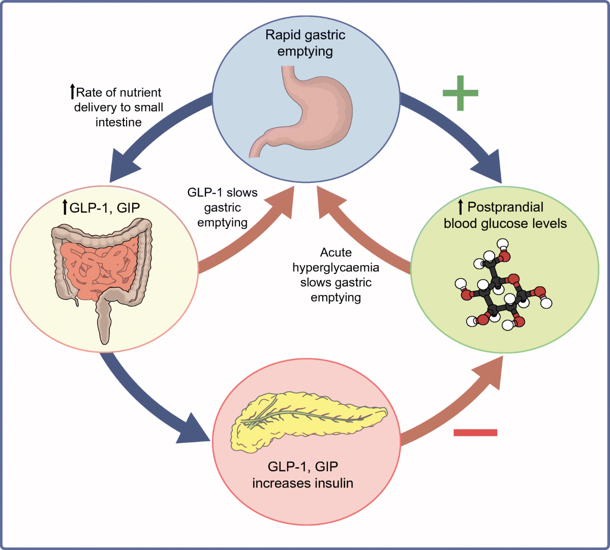 does cagrilintide slow gastric emptying Normal and disordered gastric emptying in diabetes: recent insights into  (patho)physiology, management and impact on glycaemic control |  Diabetologia