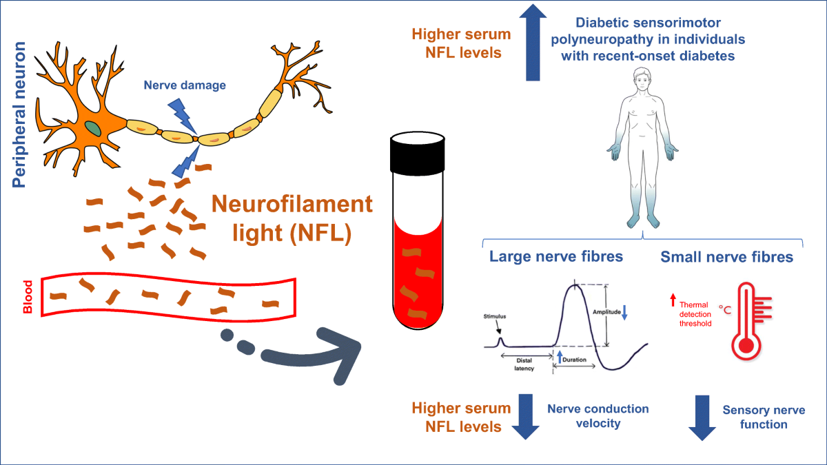 Serum neurofilament light chain: a novel biomarker for early diabetic  sensorimotor polyneuropathy | Diabetologia | Springer Nature Link