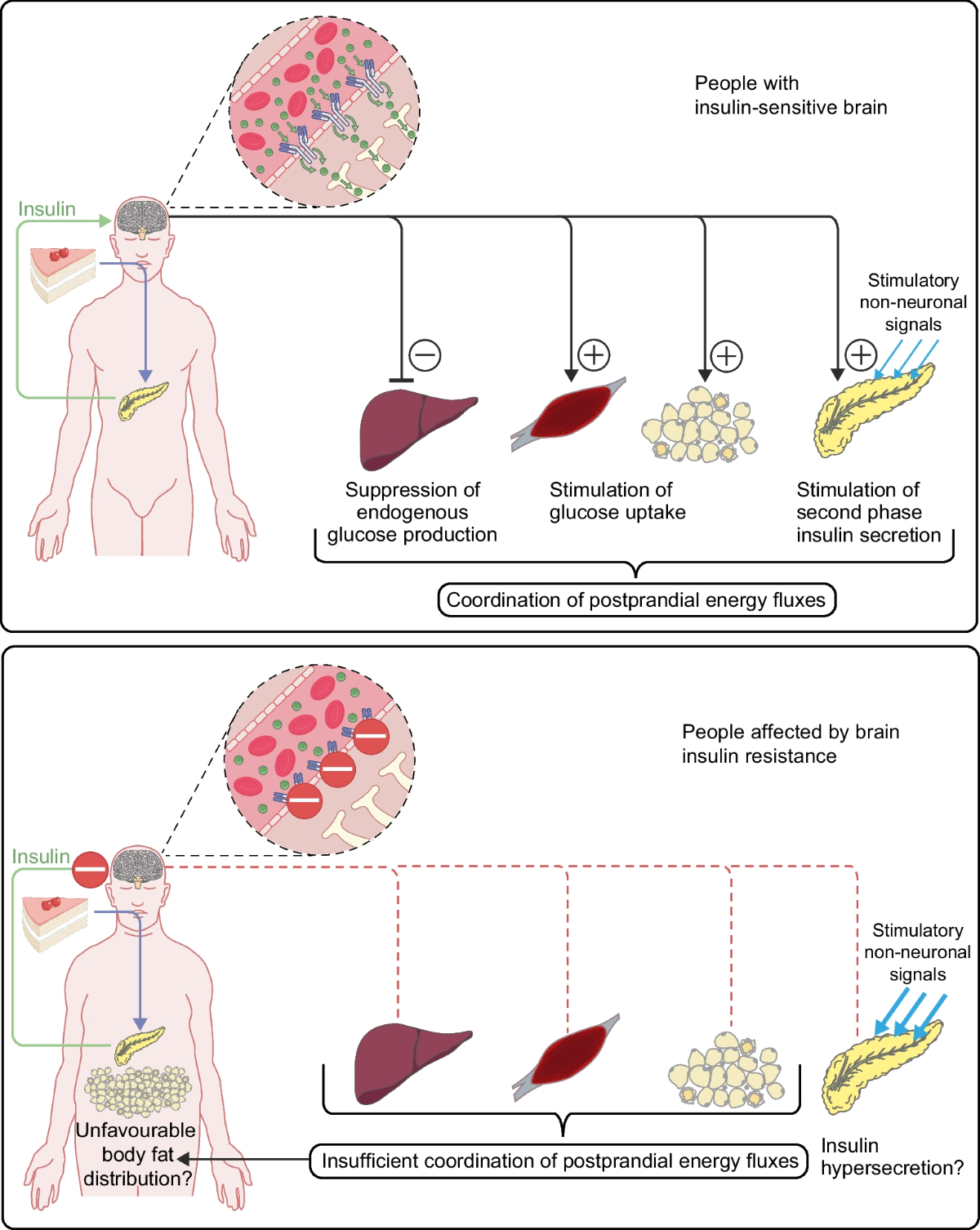 The insulin resistant brain: impact on whole-body metabolism and 